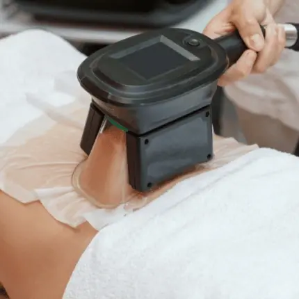 Criolipolise New Peel circle