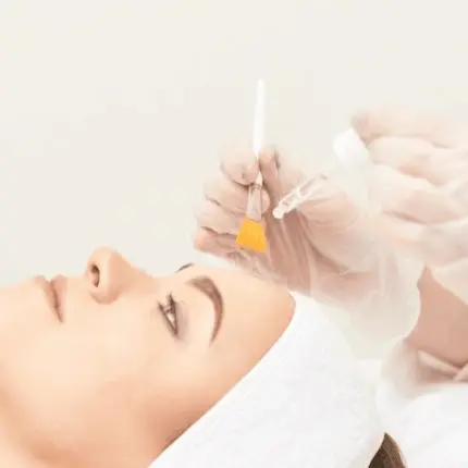 Peeling Na New Peel circle